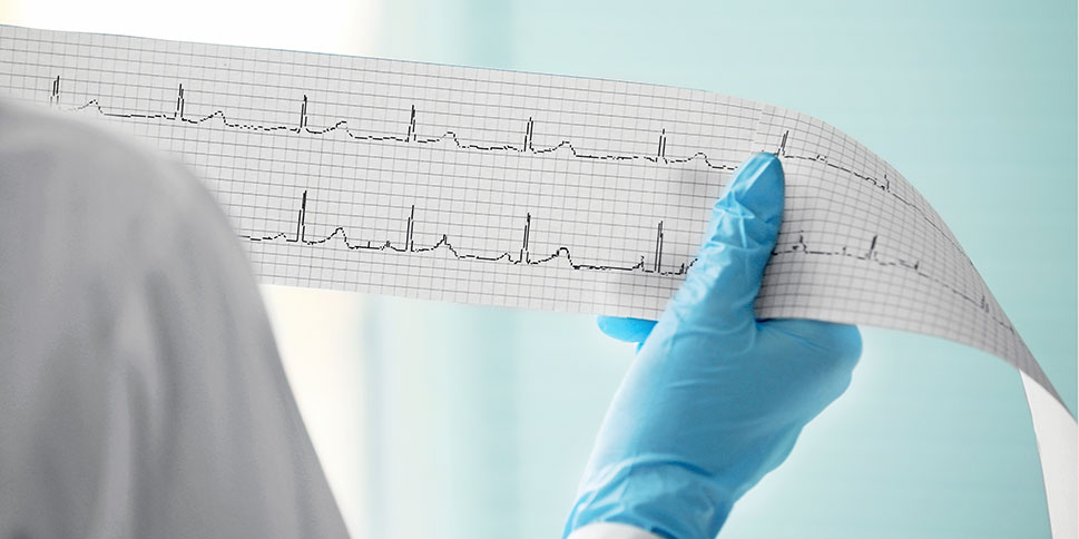 Успешное лечение кардиогенного шока с применением устройства вспомогательного кровообращения