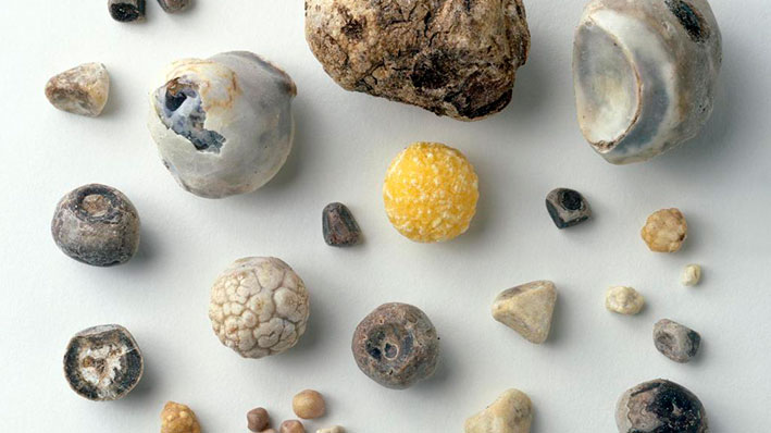 Камни в желчном пузыре как называется гепатопротекторы препараты
