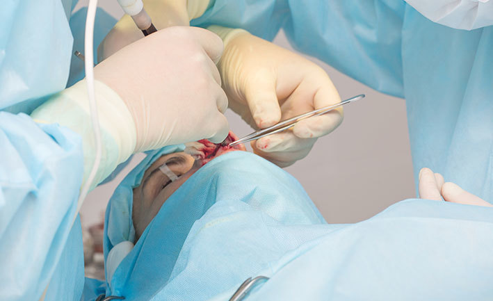 rinoplastika-operatsiya